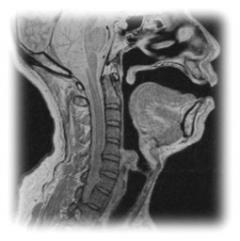 MRIによる声道の断面イメージ